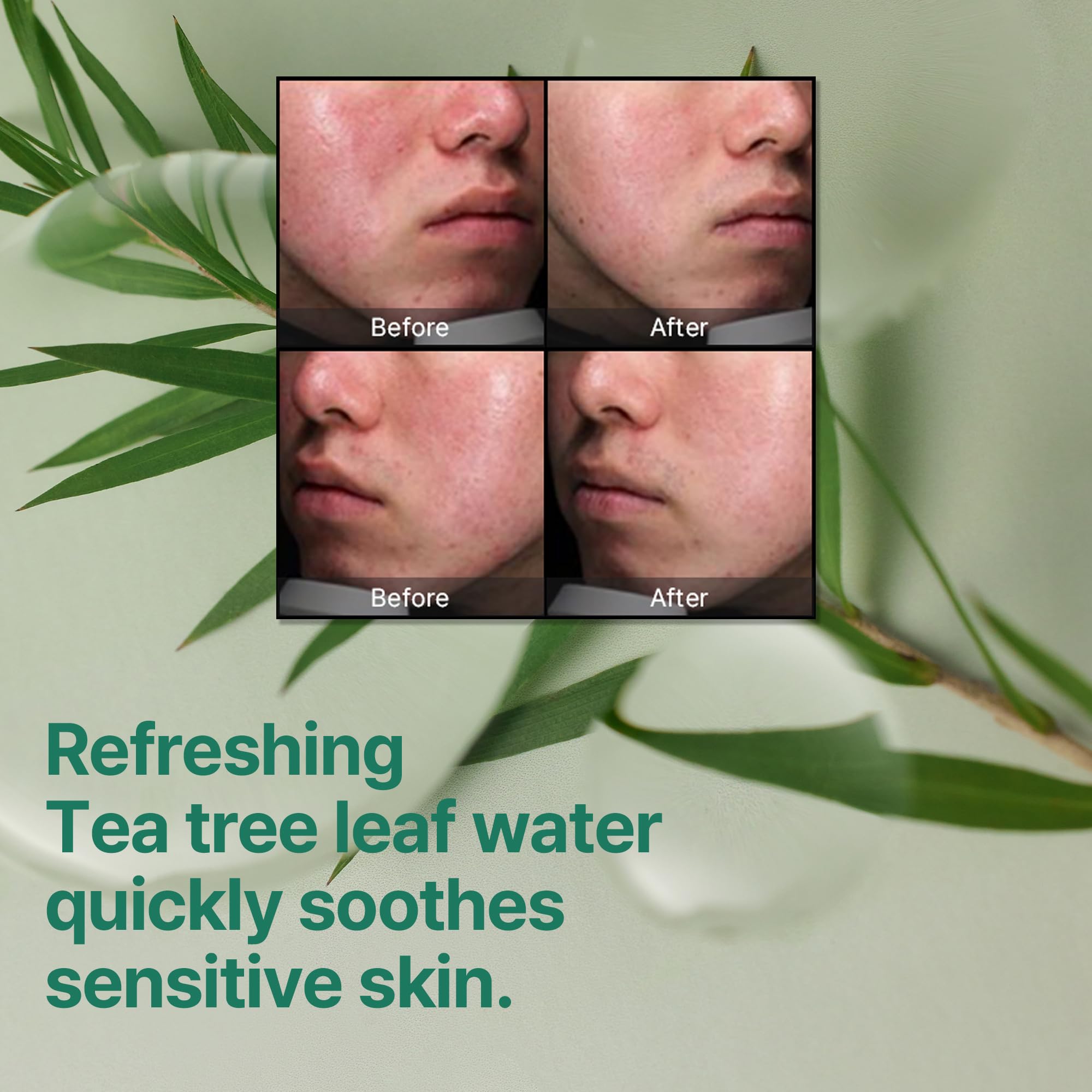 SOME BY MI dermatology-tested label signals sensitive-skin safety