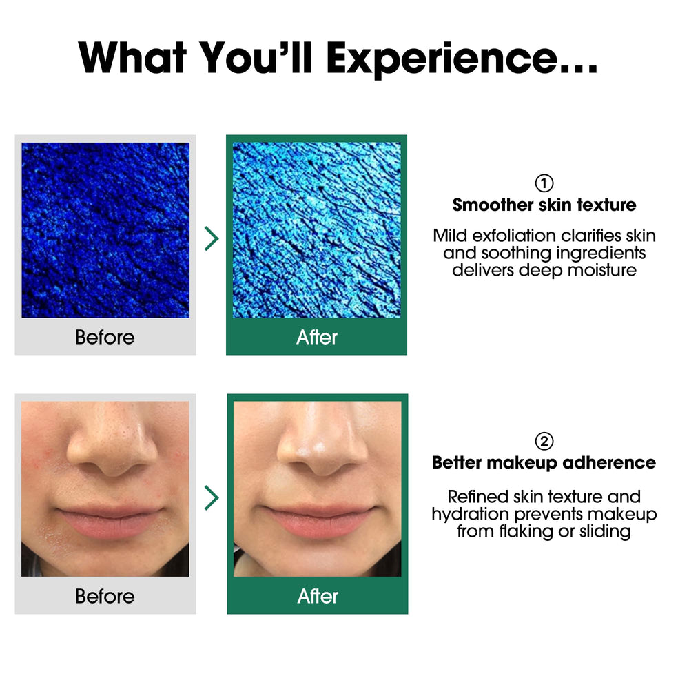 SOME BY MI hands applying toner demonstrates easy routine integration.