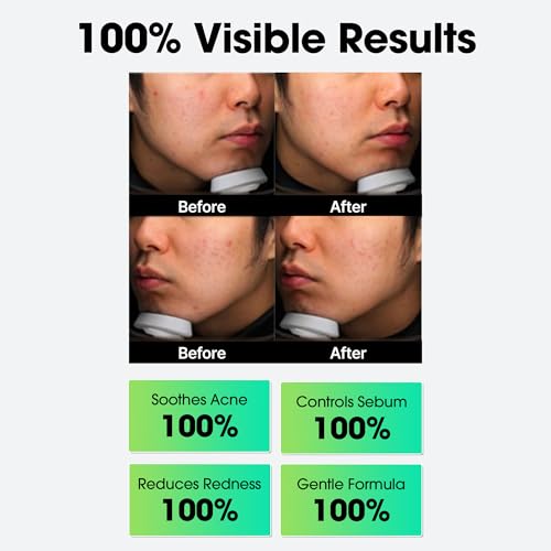 SOME BY MI niacinamide brightening visual hints at even-toned skin.