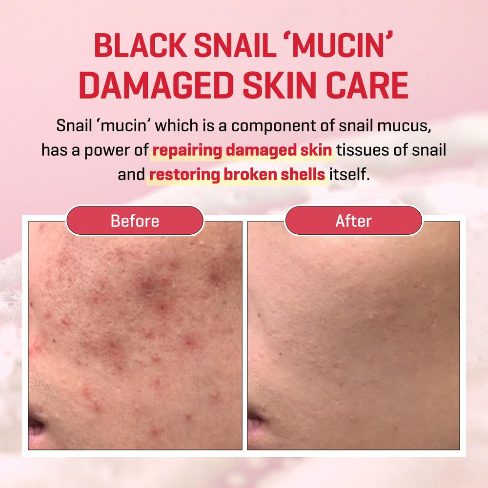 SOME BY MI Snail Truecica ingredients panel highlights snail mucin and ceramides.