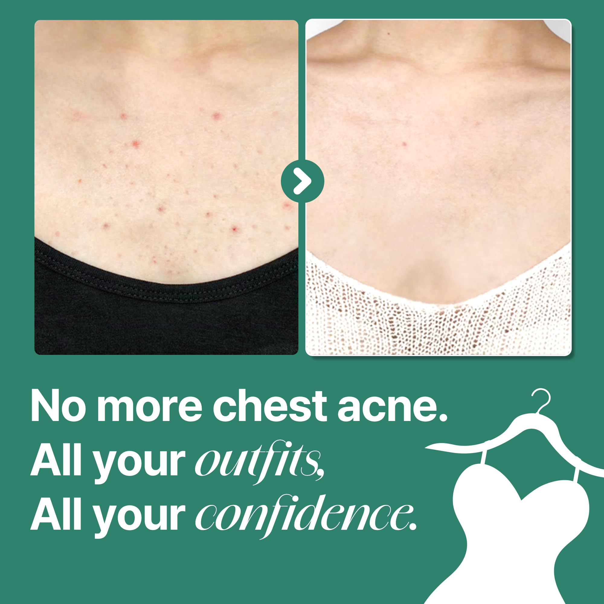 SOME BY MI Truecica calming agent visual for balanced sensitive skin care.