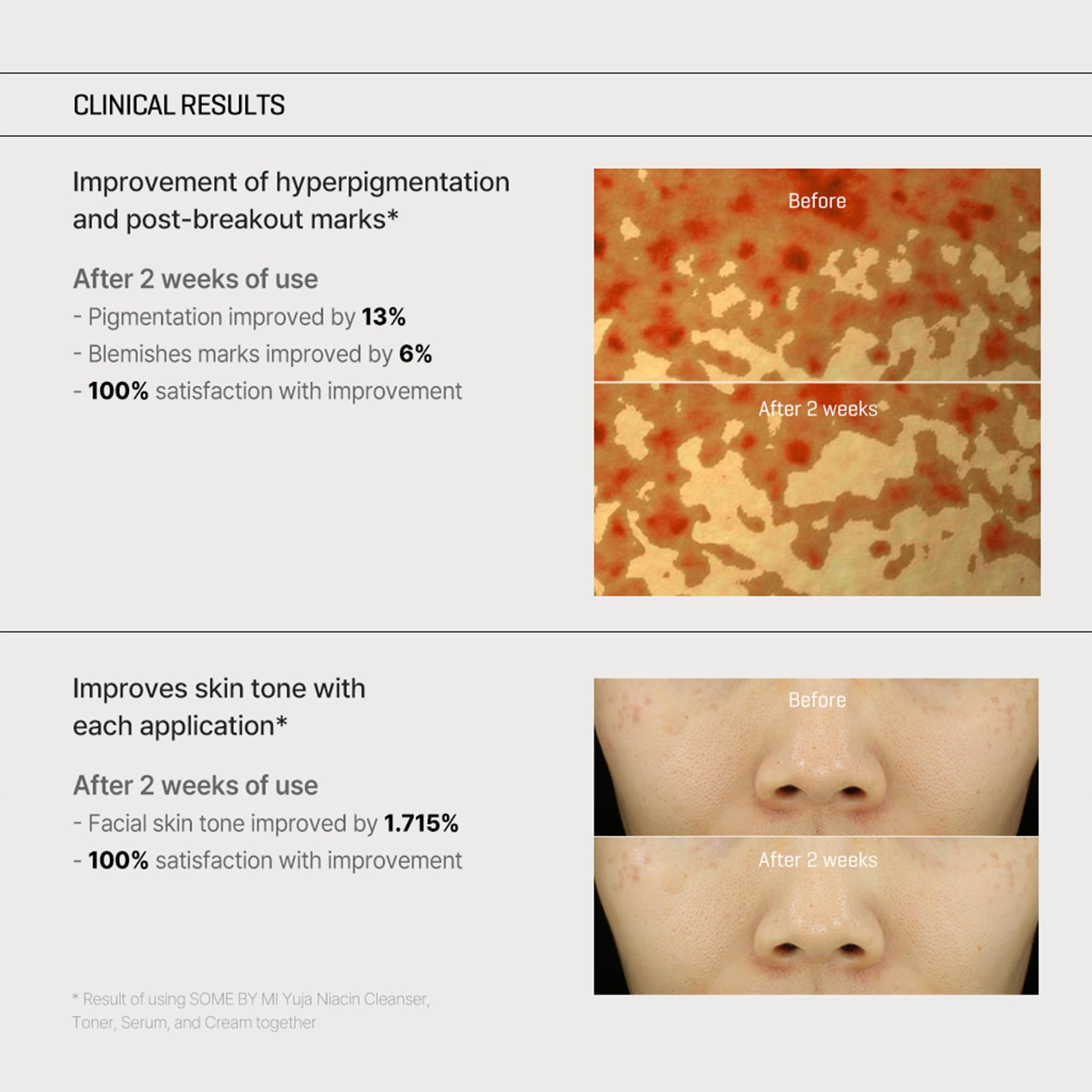 SOME BY MI Yuja Niacin Anti Blemish Cream in morning routine with sunscreen support