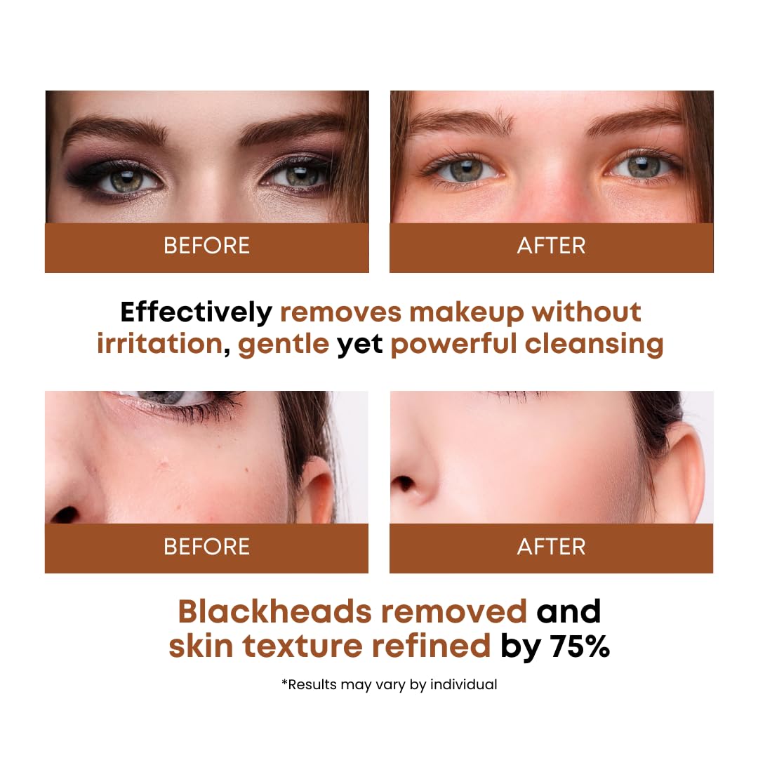 SOMISOME Korean skin care certified Excellent Dermatest signals safe, low-irritation formula.