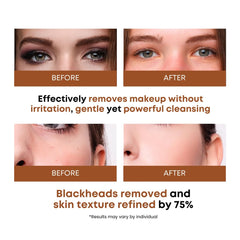 SOMISOME Korean skin care certified Excellent Dermatest signals safe, low-irritation formula.