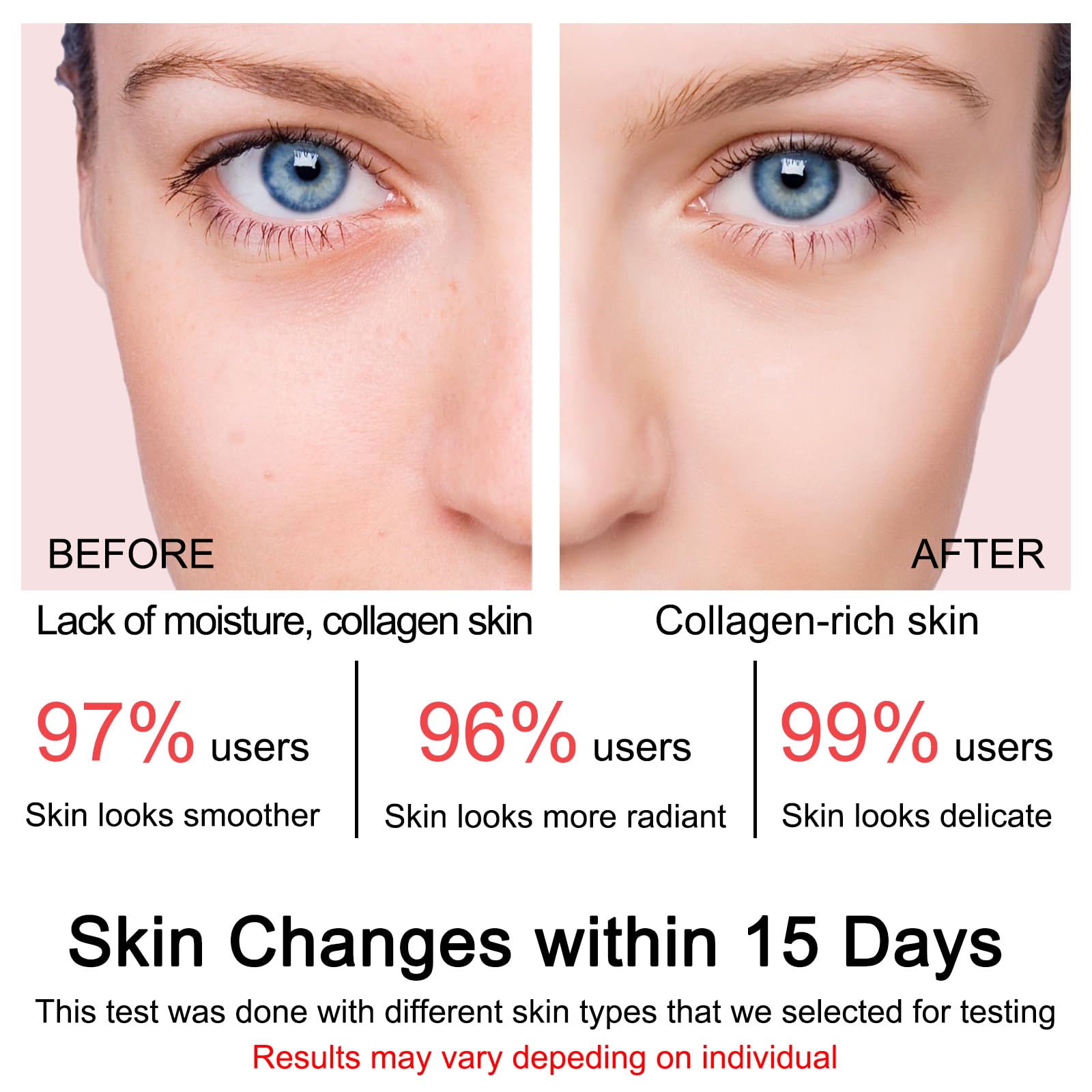 SOYUB Collagen Jelly Cream night routine image hints overnight firmness.