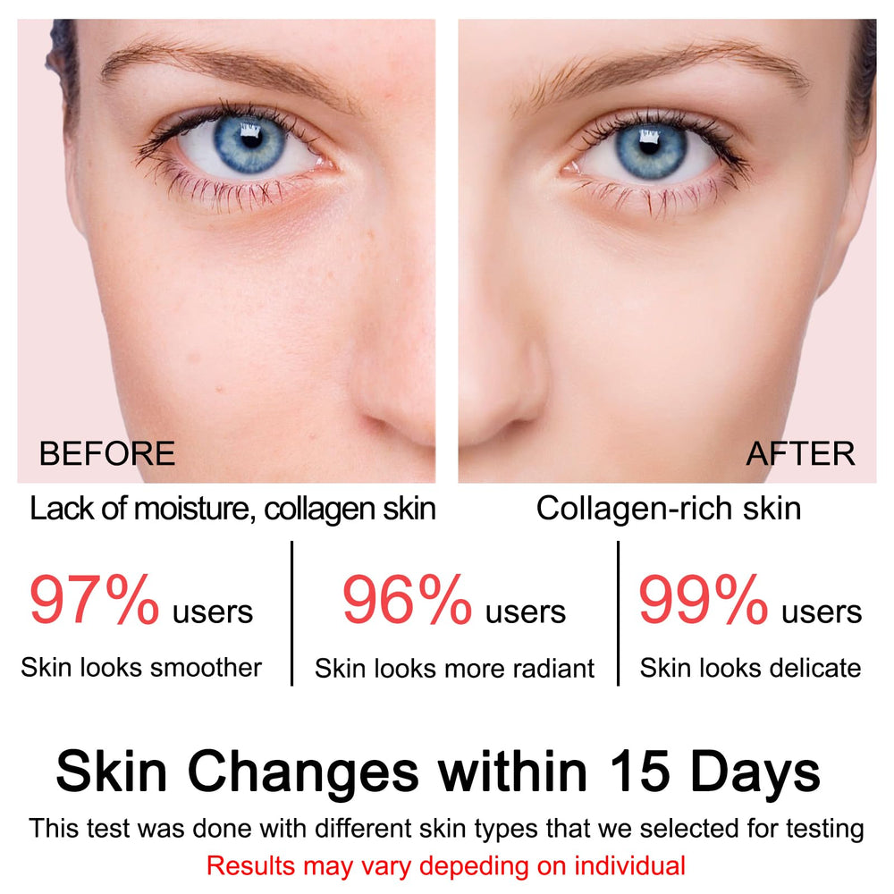 SOYUB Collagen Jelly Cream night routine image hints overnight firmness.