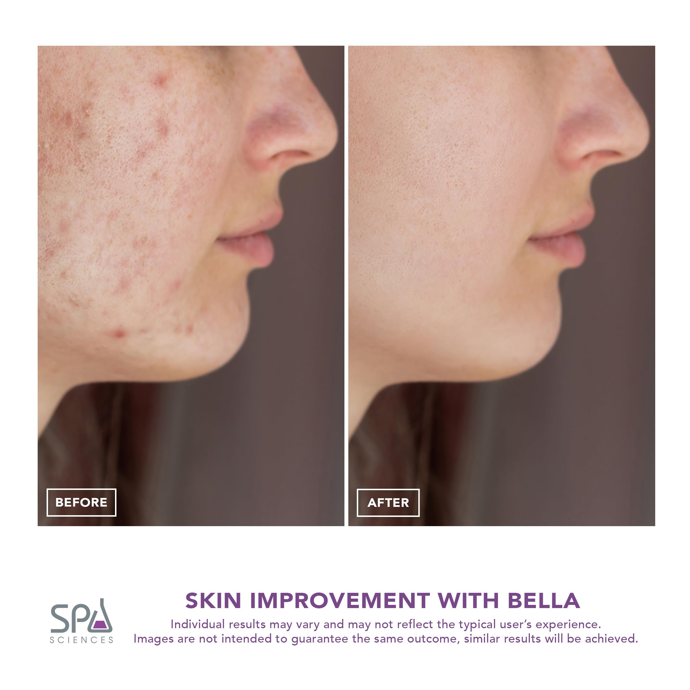 Travel case setup for Spa Sciences Bella cordless device on the go