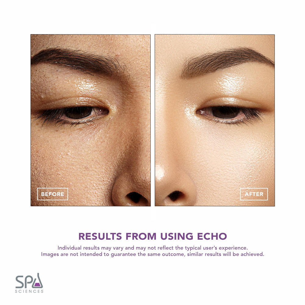 Spa Sciences ECHO USB charging icon highlights convenient recharge
