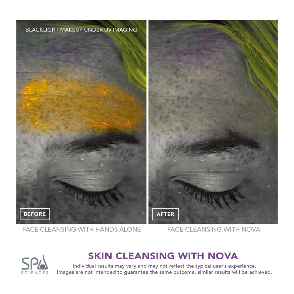 Spa Sciences NOVA high-speed sonic motor delivers 18,000 movements per minute.