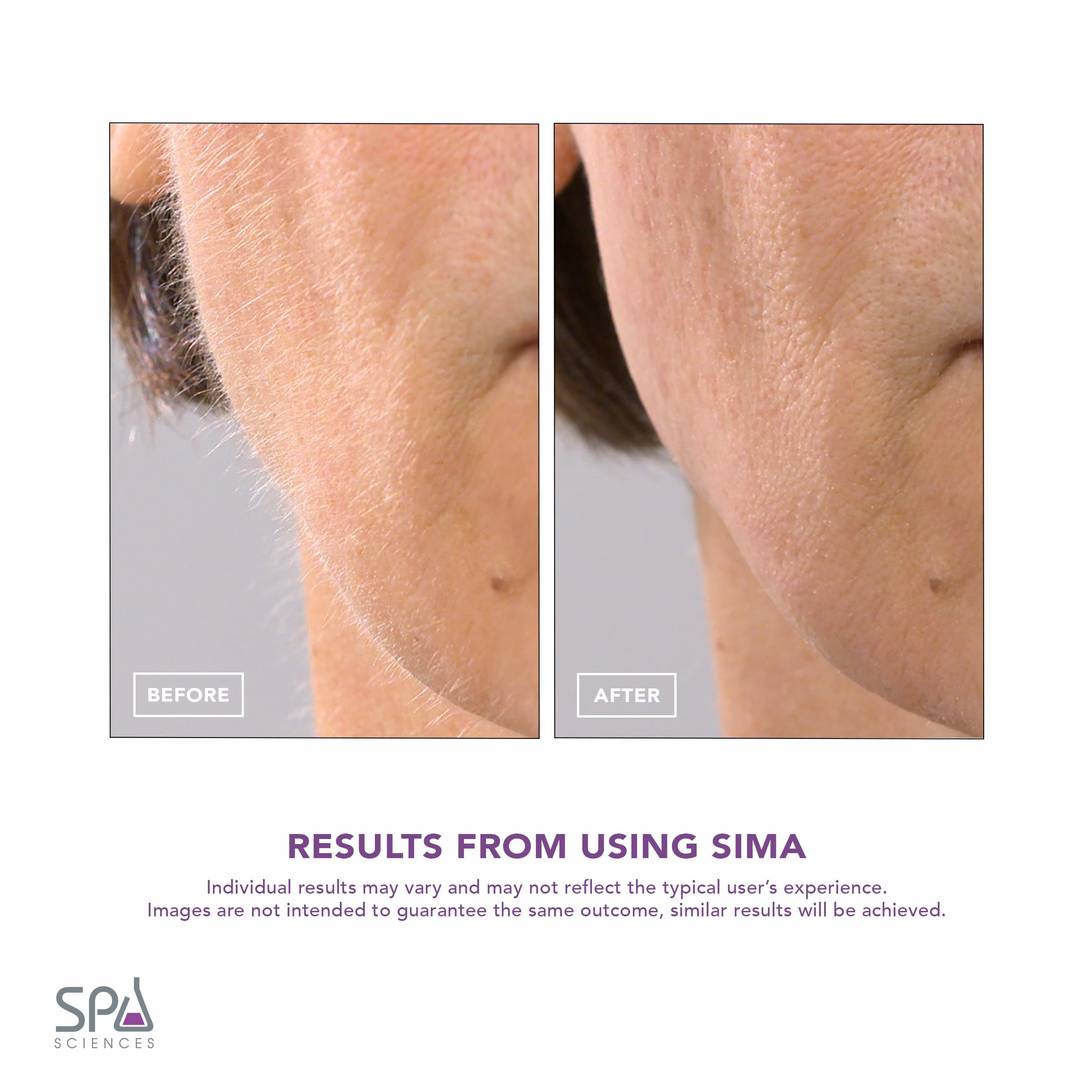 SPA SCIENCES SIMA 3-speed settings offer tailored exfoliation intensity.