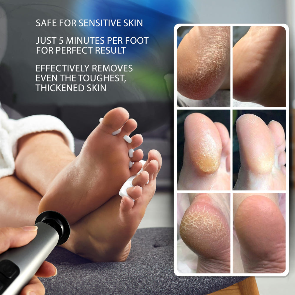 Spargos black design foot file close-up ergonomic grip