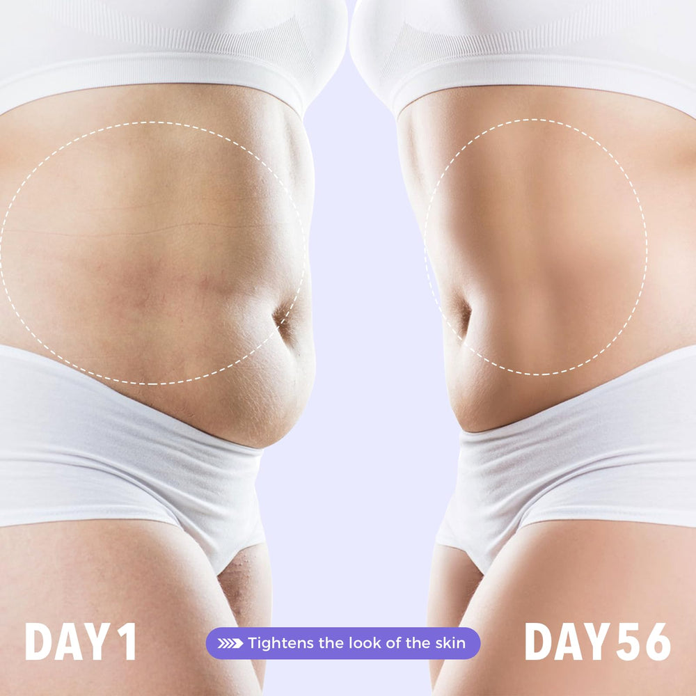 Sperandi Overnight Toning Whip application on legs for smoother look