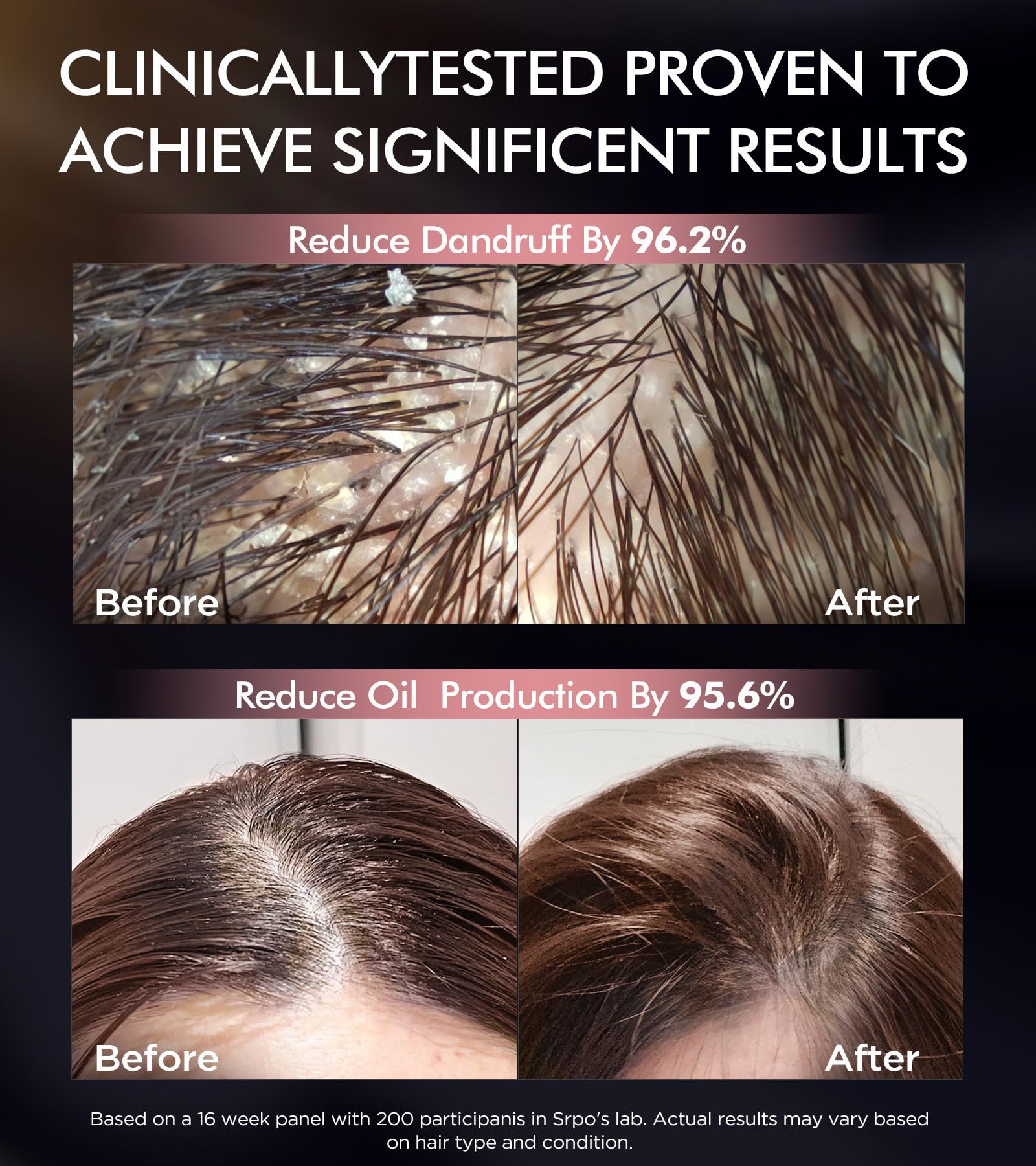 Srripo Moroccan argan oil nourishes hair for softness and shine