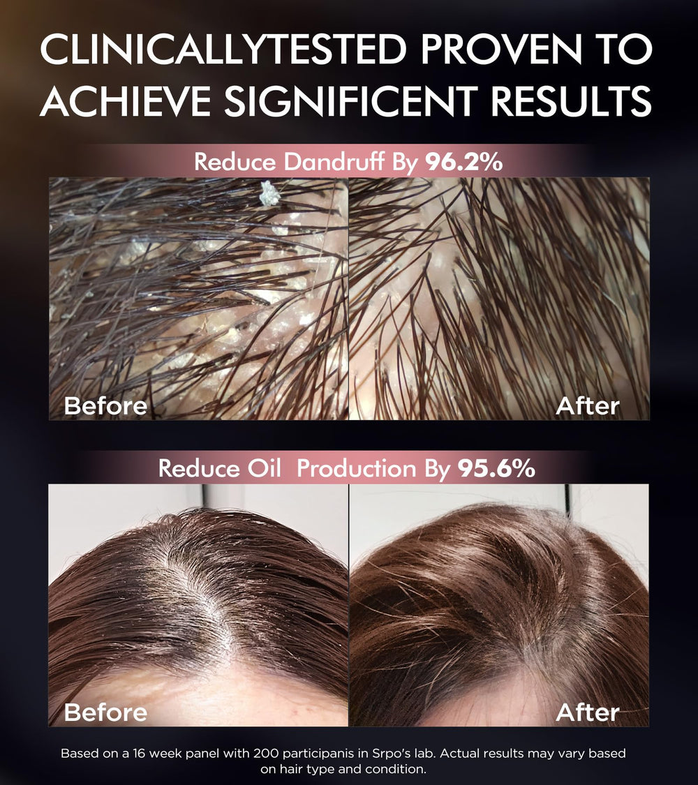 Srripo Moroccan argan oil nourishes hair for softness and shine