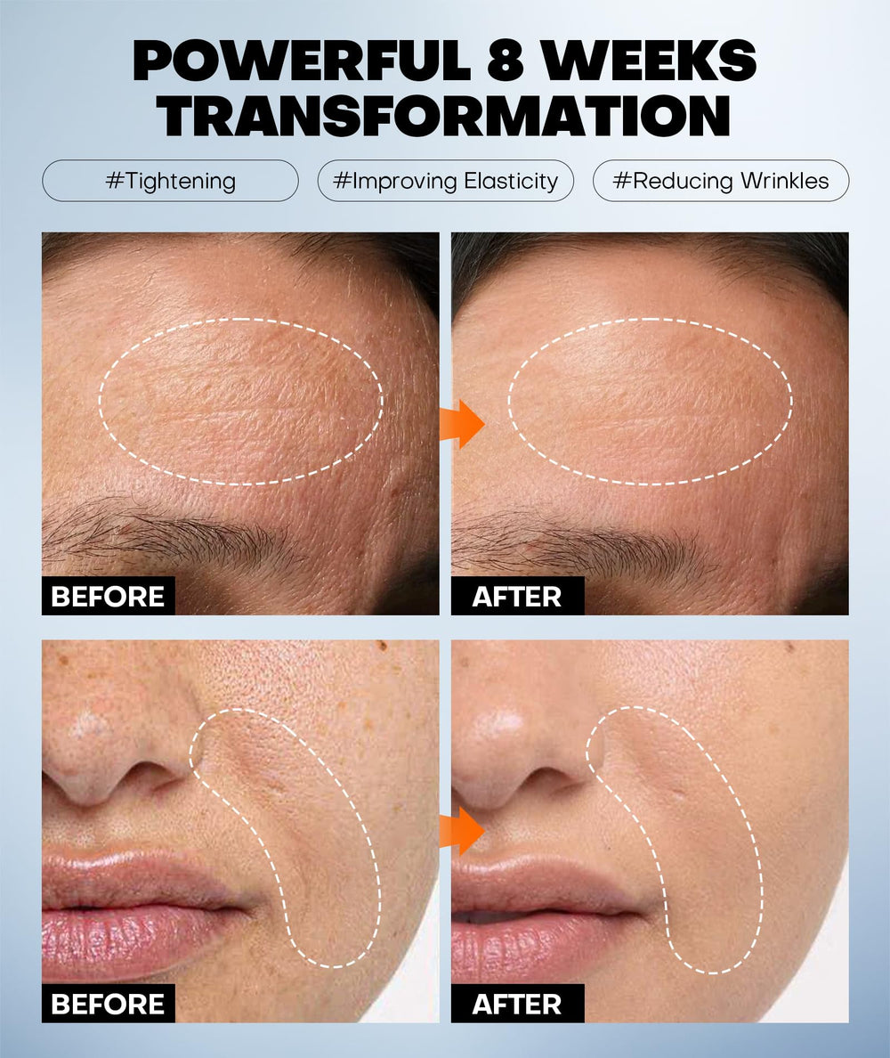 Srripo Radiant Glow Mask small-molecule collagen peptides for firming.