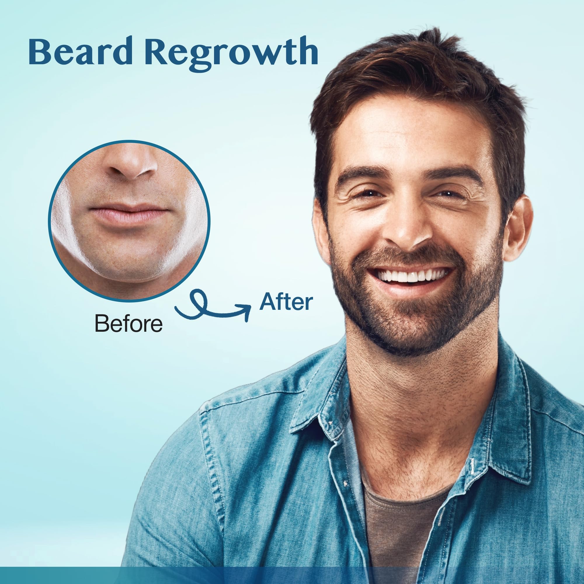 Stafenit minoxidil daily-serum dropper delivering fast-absorbing scalp treatment