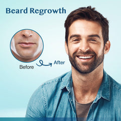 Stafenit minoxidil daily-serum dropper delivering fast-absorbing scalp treatment