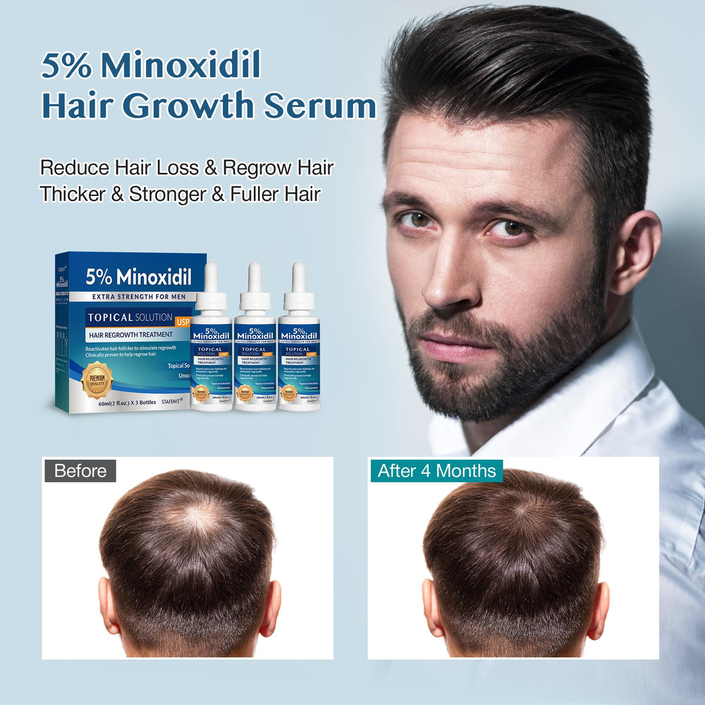 Stafenit thinning hair crown area close-up highlighting density support
