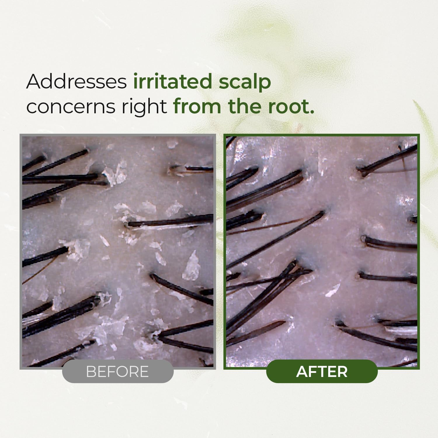 Steambase Tea Tree Scalp Treatment before shampoo promotes deep cleansing.