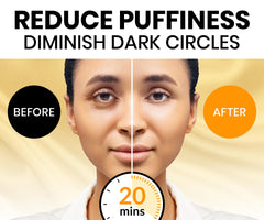 Stylia 24k gold eye patches pack highlighting radiant look