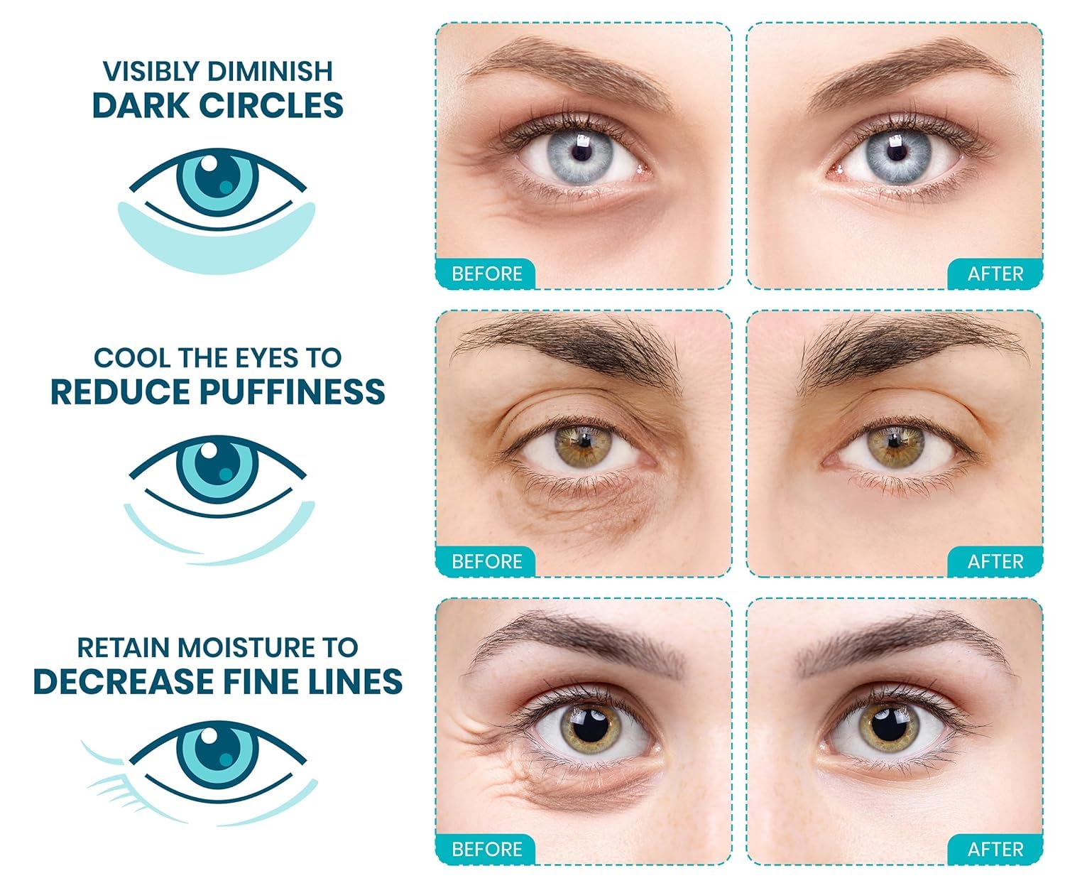 Stylia under-eye patches soothing skin close-up emphasizes calming, nourishing effects after use.