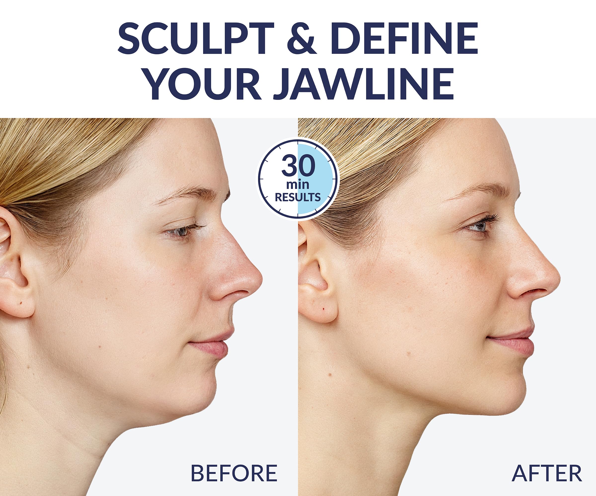 Stylia V Line neck-tightening application showing jawline refinement potential.