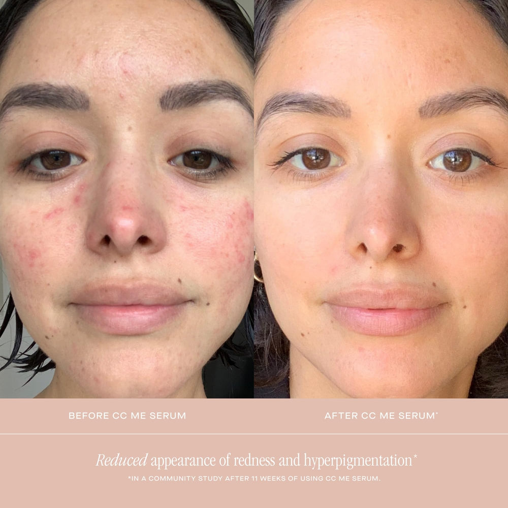 Applying CC Me Serum to face and neck as part of routine.