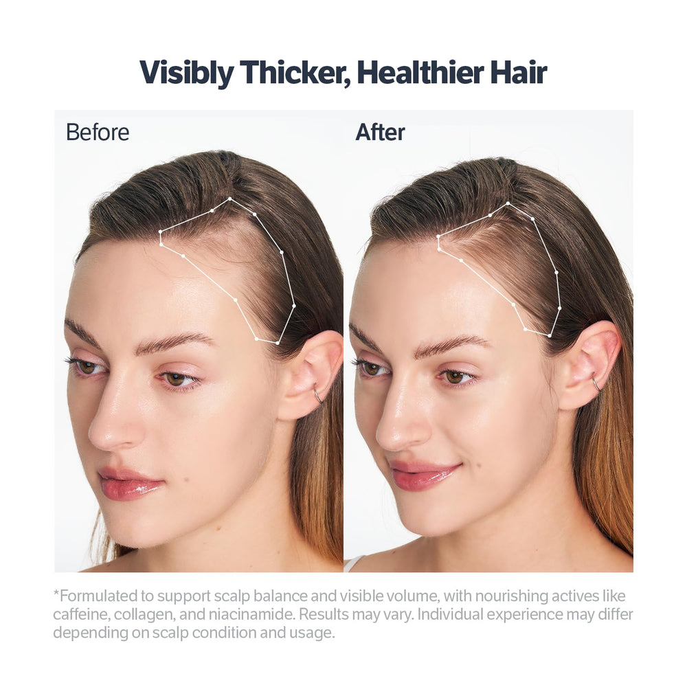 SUNGBOON EDITOR scalp serum roll-on head close-up for precise application and quick refresh