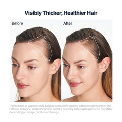 SUNGBOON EDITOR scalp serum roll-on head close-up for precise application and quick refresh