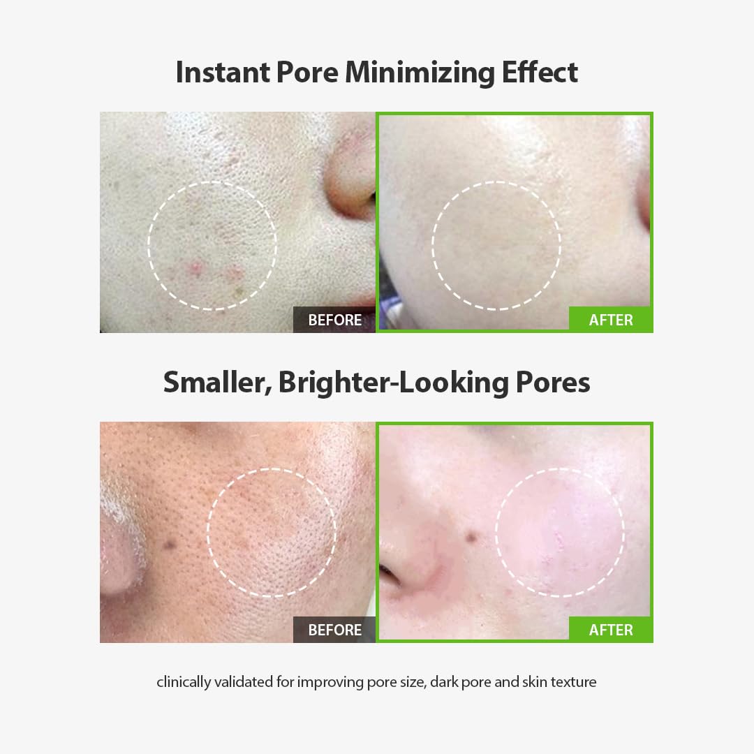 SUNGBOON EDITOR green tomato pore lifting ampoule application shows smooth, refreshed skin after use
