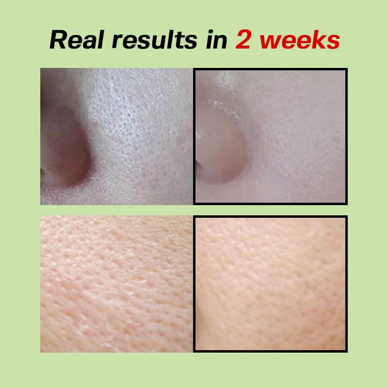 SUNGBOON EDITOR green tomato pore lifting ampoule on face shows hydration and firming