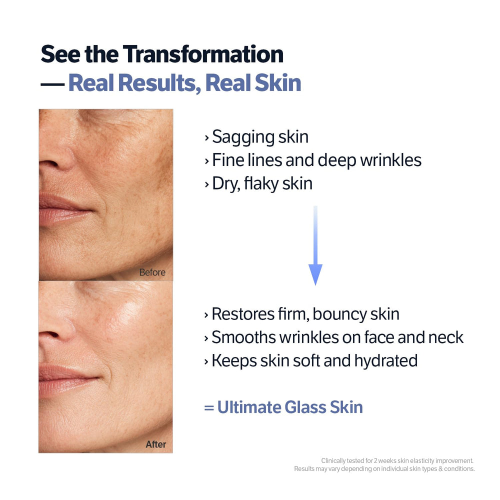 SUNGBOON EDITOR micro spicules closeup illustrating gentle skin stimulation