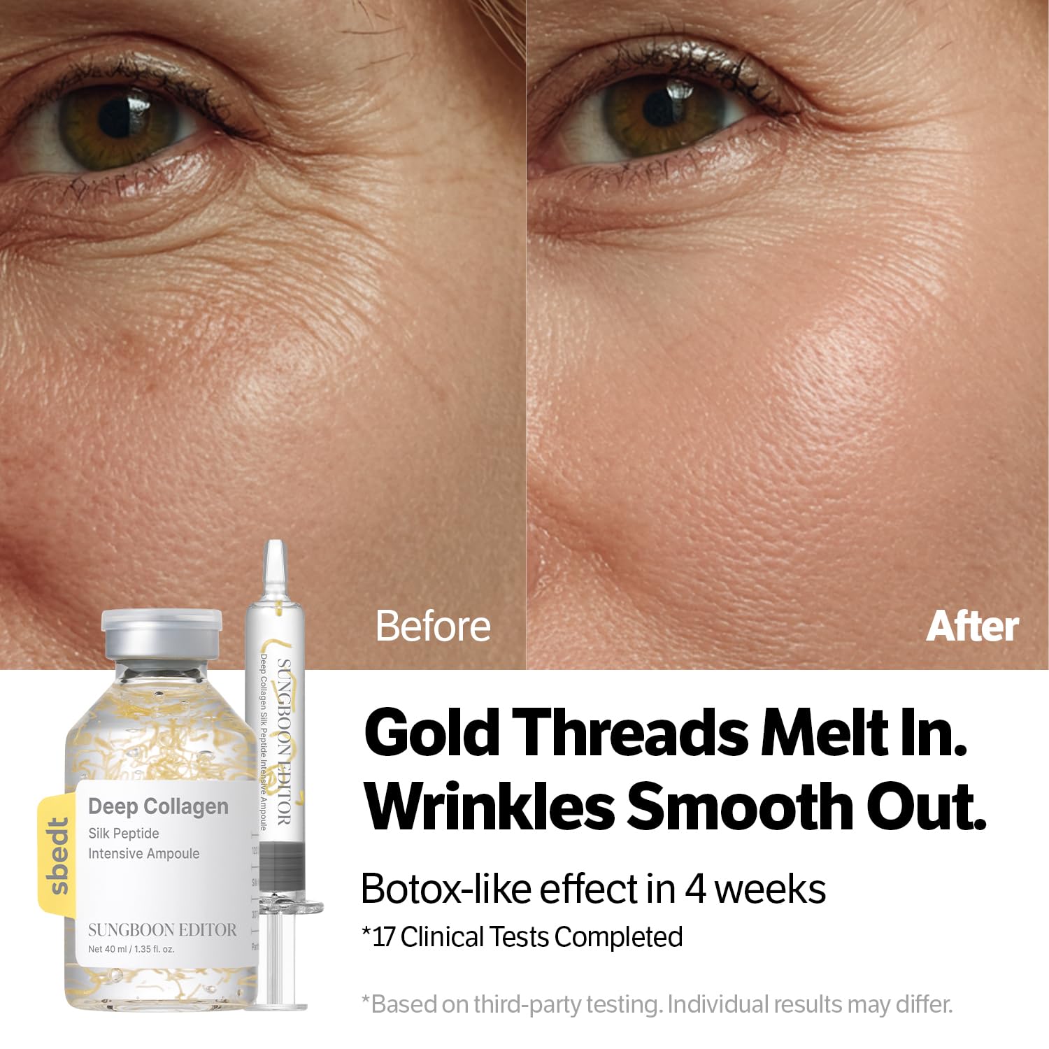 SUNGBOON EDITOR silk thread technology closeup illustrating lifting mechanism and tightening potential