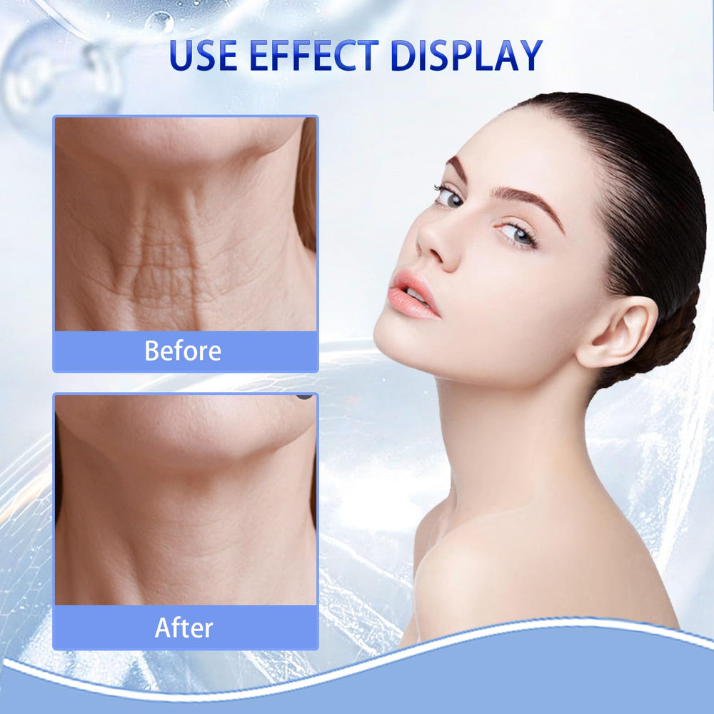 Sunnydeer face jaw firming tapes target lower face for smoother lines