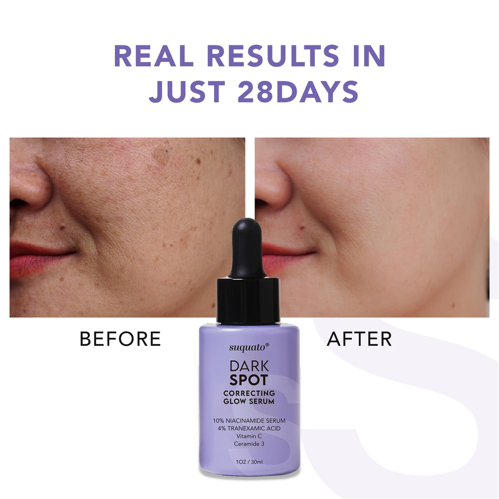 Suquato serum on skin showing brightening effect and smooth texture