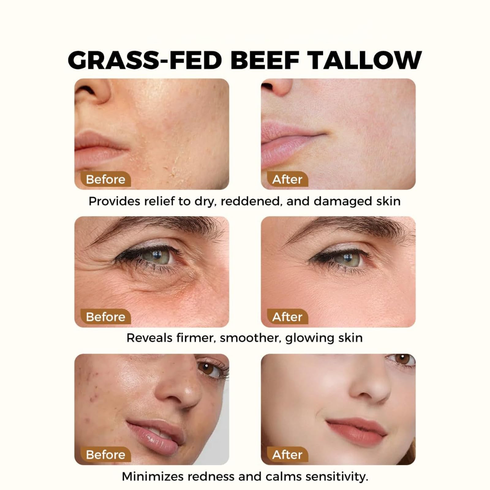 SURORAIN grass-fed shea butter application on skin