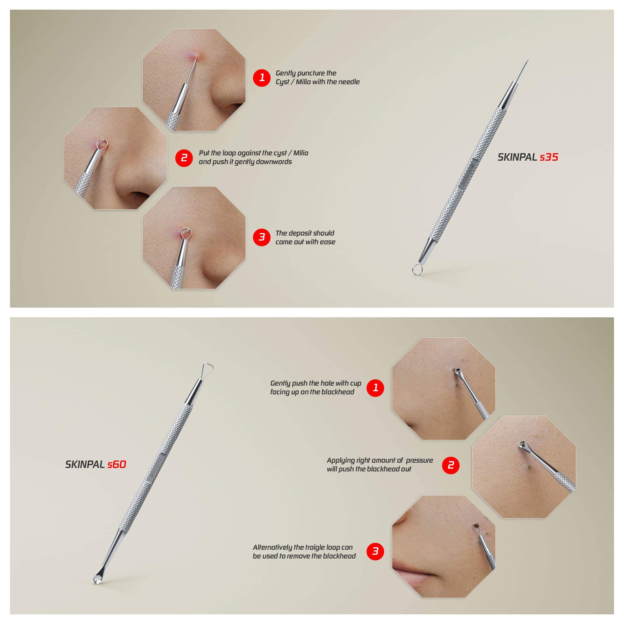 Suvorna pimple popper tool kit assembled with stainless steel implements