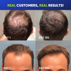 Svvimer rosemary tea tree oil image emphasizes refreshing scalp care with natural oils