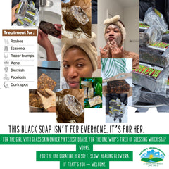 Sweet Sunnah Black Seed soap bar closeup highlights natural oils for moisturized skin.