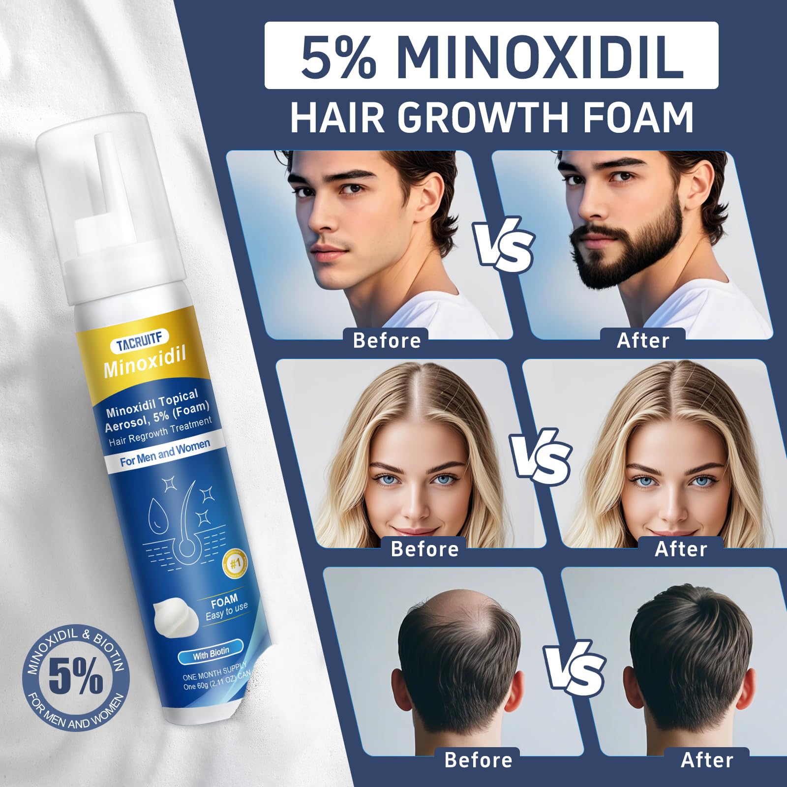 Tacruitf Minoxidil Foam pump-action showing easy daily use
