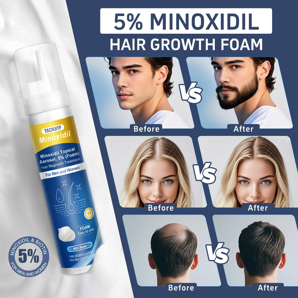 Tacruitf Minoxidil Foam pump-action showing easy daily use