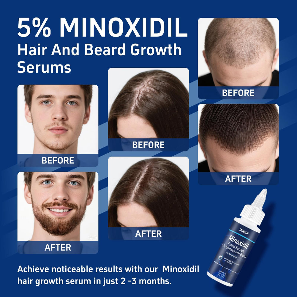 Tacruitf unscented minoxidil application promotes gentle scalp use.