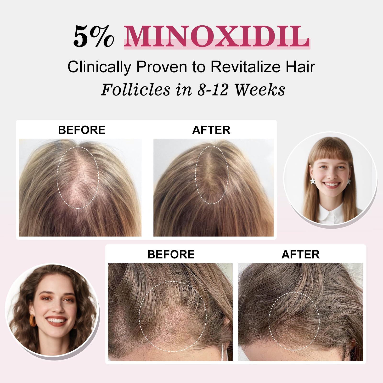 TAGOQHIA women’s regrowth spray applied to thinning scalp areas