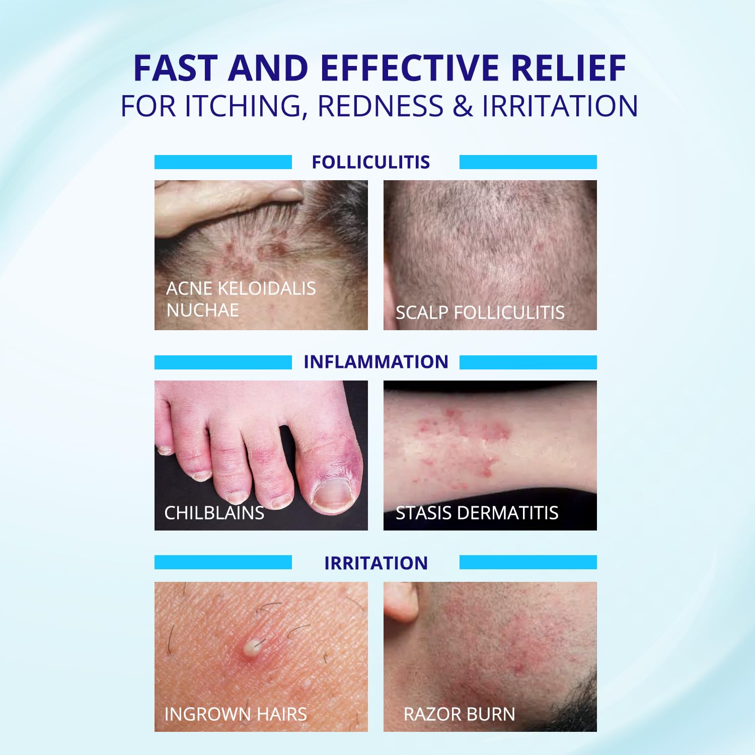 TAGRID Folliculitis Cream application on arm demonstrating quick absorption.
