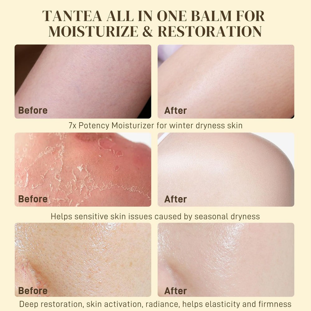 Tantea face and body moisturizer bottle signals versatile all‑in‑one hydration.