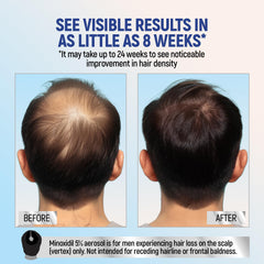 TARO Minoxidil 4-pack packaging showing a four-month supply for men.