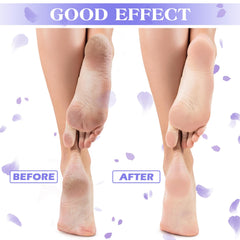 Tarpop Aloe Socks Purple Points Pack features massaging points for even moisture.