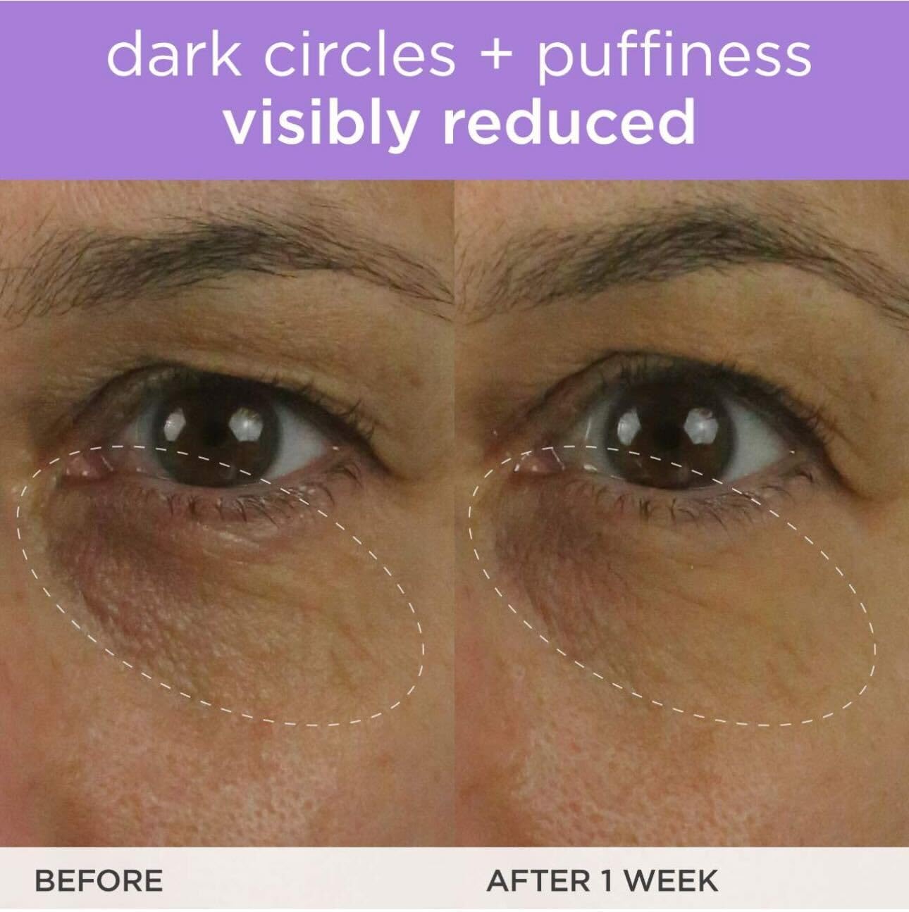 TATCHA Brightening Eye Cream vitamin C illustration emphasizes the time-release boost
