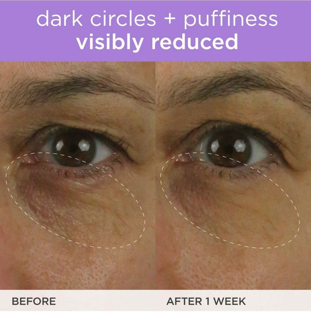 TATCHA Brightening Eye Cream vitamin C illustration emphasizes the time-release boost