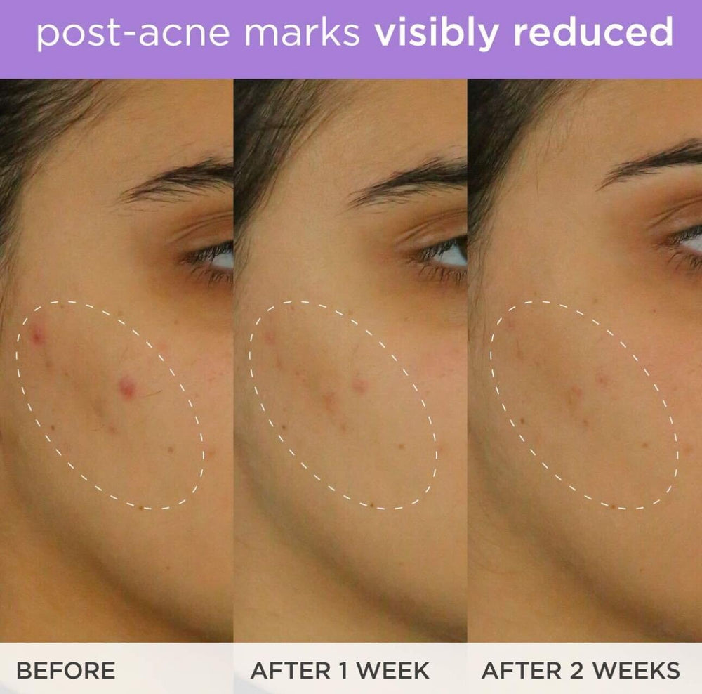 TATCHA Brightening Serum daily routine with other skincare steps.